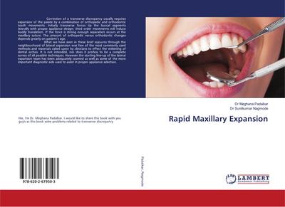 Rapid Maxillary Expansion