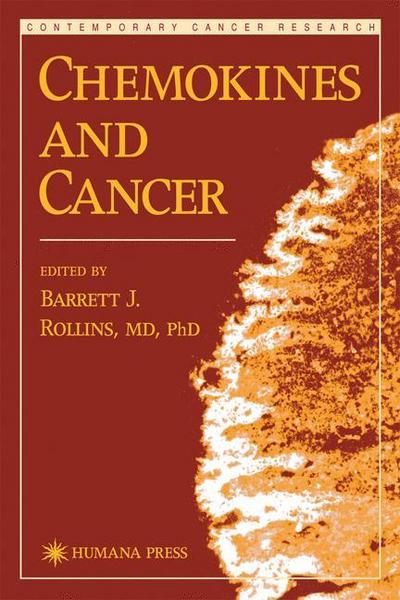 Chemokines and Cancer