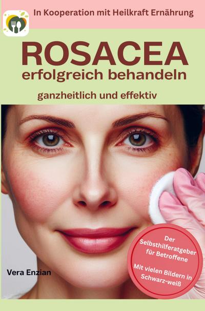 Rosacea erfolgreich behandeln - ganzheitlich und effektiv: Der Selbsthilferatgeber für Betroffene mit Tipps, die wirklich funktionieren