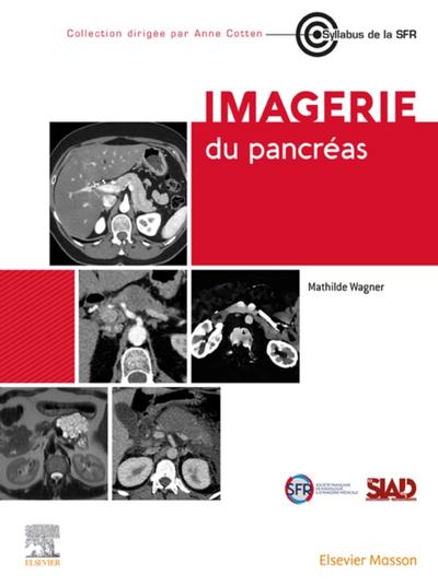 Imagerie du pancreas