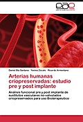 Arterias humanas criopreservadas: estudio pre y post implante