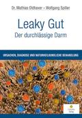 Leaky Gut - Der durchlässige Darm