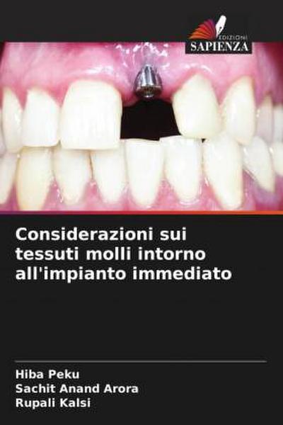 Considerazioni sui tessuti molli intorno all’impianto immediato