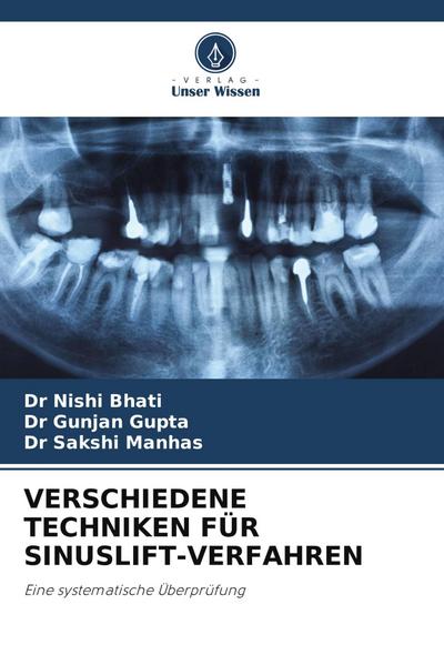 VERSCHIEDENE TECHNIKEN FÜR SINUSLIFT-VERFAHREN
