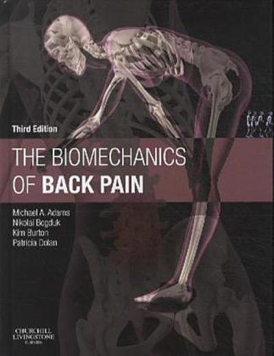 The Biomechanics of Back Pain
