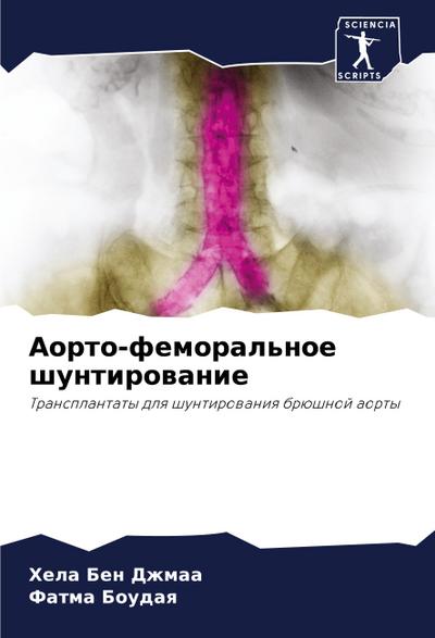Aorto-femoral’noe shuntirowanie