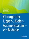 Chirurgie der Lippen-, Kiefer-, Gaumenspalten – ein Bildatlas von Marco Kesting | Ebook