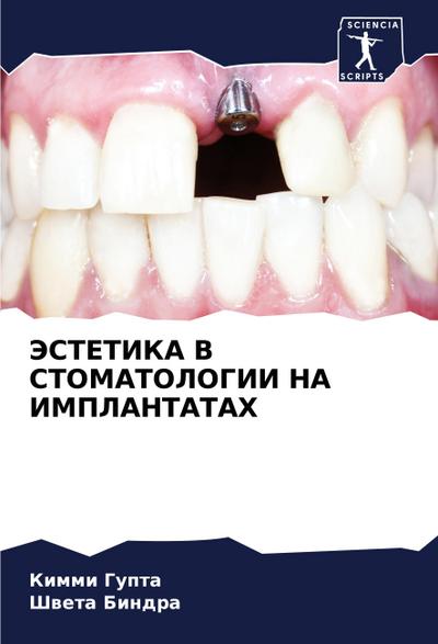 JeSTETIKA V STOMATOLOGII NA IMPLANTATAH