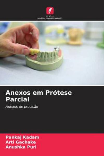 Anexos em Prótese Parcial
