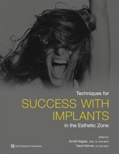 Techniques for Success With Implants in the Esthetic Zone (eBook, EPUB) - Arndt Happe
