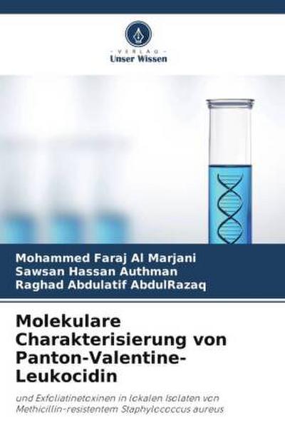 Molekulare Charakterisierung von Panton-Valentine-Leukocidin