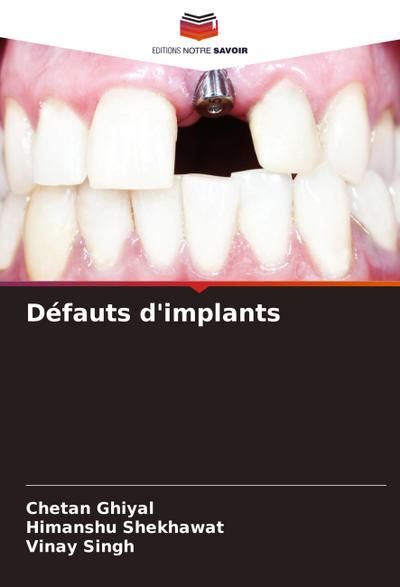 Défauts d’implants