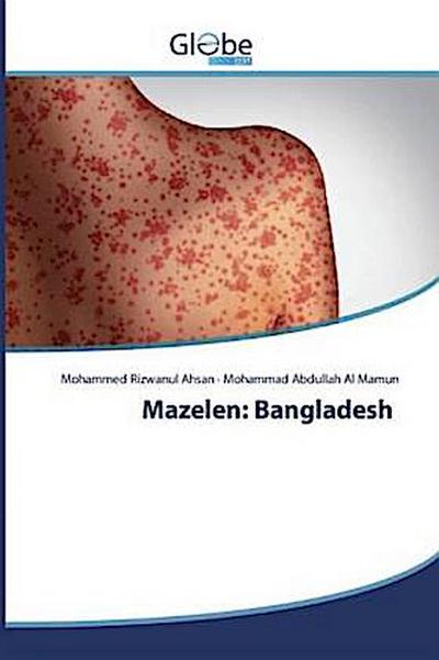 Mazelen: Bangladesh