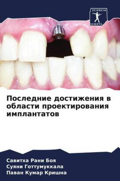 Poslednie dostizheniq w oblasti proektirowaniq implantatow