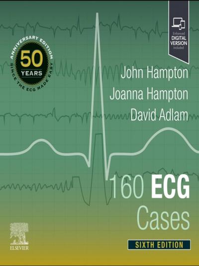 160 ECG Cases