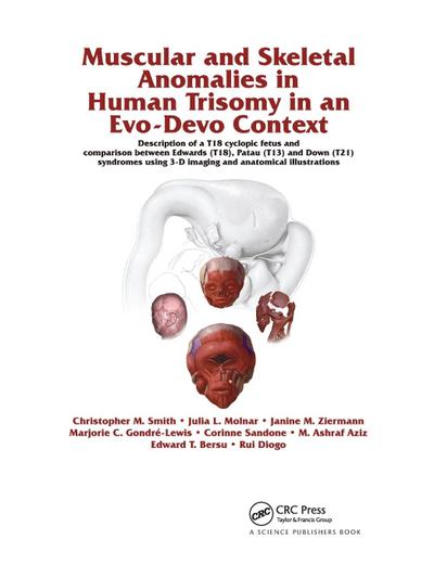 Muscular and Skeletal Anomalies in Human Trisomy in an Evo-Devo Context
