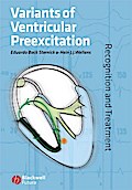 Variants of Ventricular Preexcitation