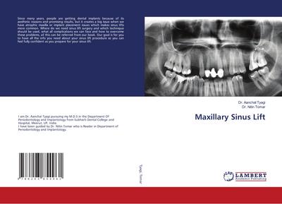 Maxillary Sinus Lift