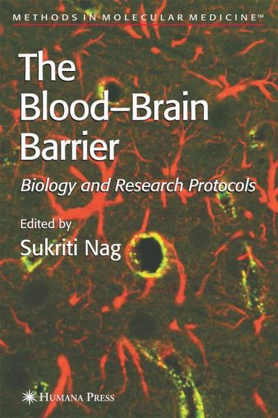 Blood’Brain Barrier