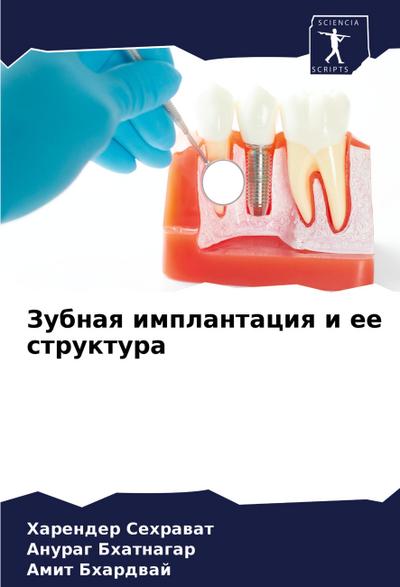 Zubnaq implantaciq i ee struktura