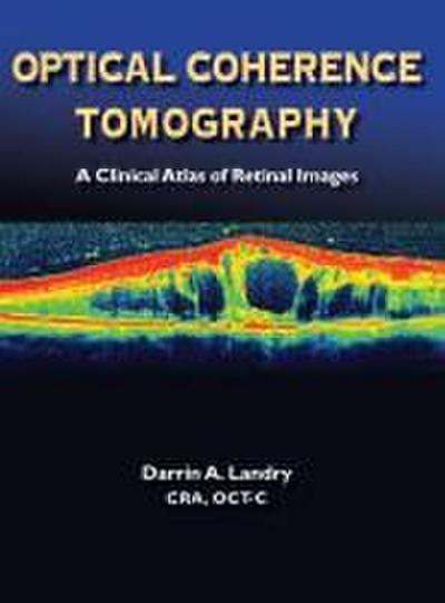 Optical Coherence Tomography