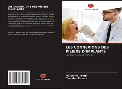 LES CONNEXIONS DES PILIERS D’IMPLANTS