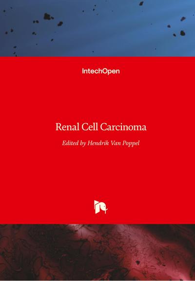 Renal Cell Carcinoma