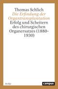 Die Erfindung der Organtransplantation