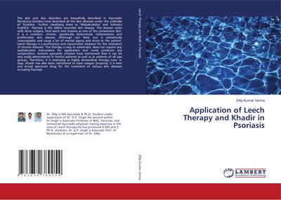 Application of Leech Therapy and Khadir in Psoriasis