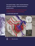 Neurosurgery of arteriovenous malformations and fi
