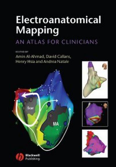 Electroanatomical Mapping