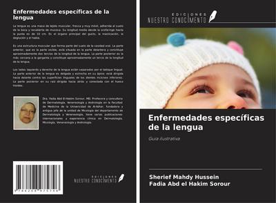 Enfermedades específicas de la lengua