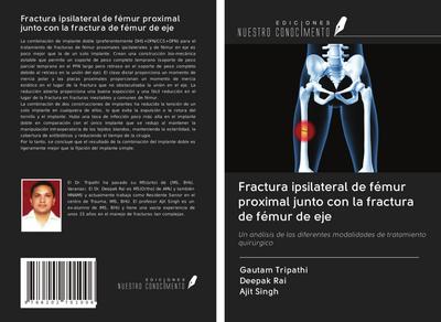Fractura ipsilateral de fémur proximal junto con la fractura de fémur de eje