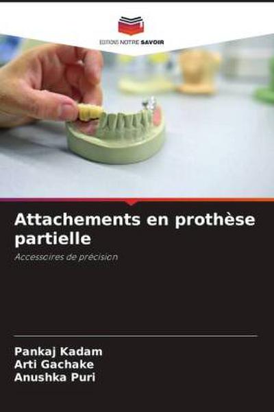 Attachements en prothèse partielle