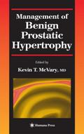 Management of Benign Prostatic Hypertrophy