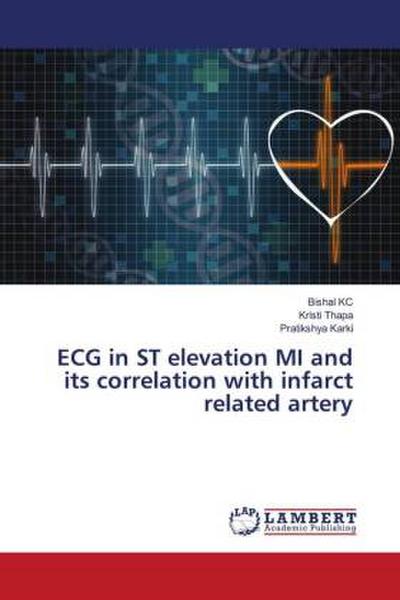 ECG in ST elevation MI and its correlation with infarct related artery
