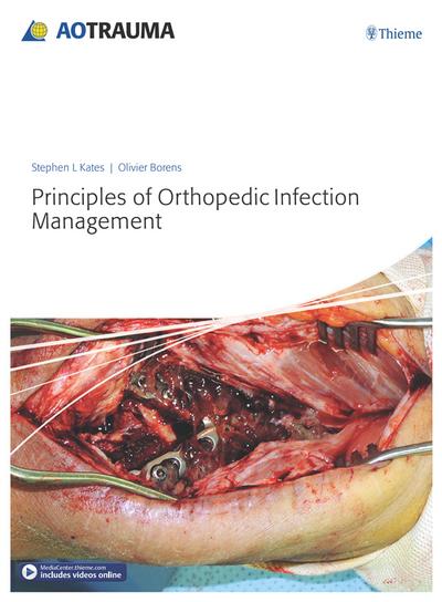 Principles of Orthopedic Infection Management