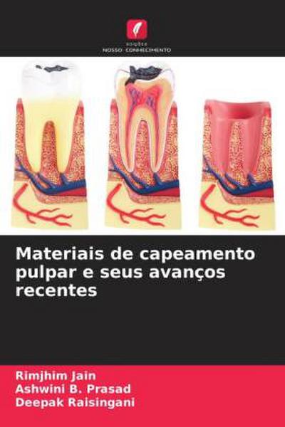 Materiais de capeamento pulpar e seus avanços recentes