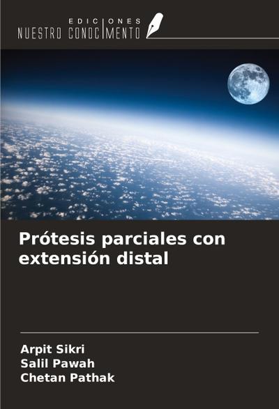 Prótesis parciales con extensión distal