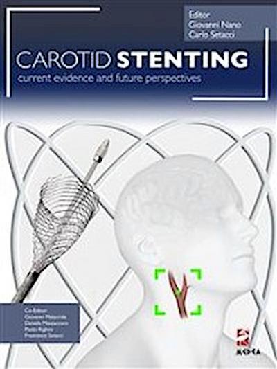 Carotid Stenting