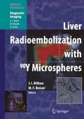 Liver Radioembolization with 90Y Microspheres