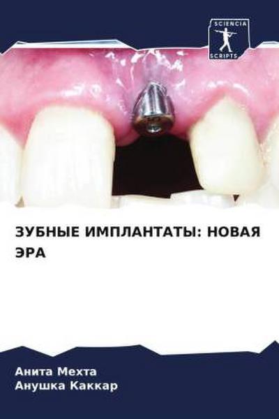 ZUBNYE IMPLANTATY: NOVAYa JeRA