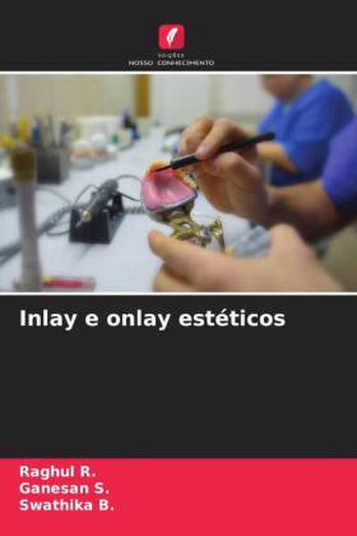 Inlay e onlay estéticos