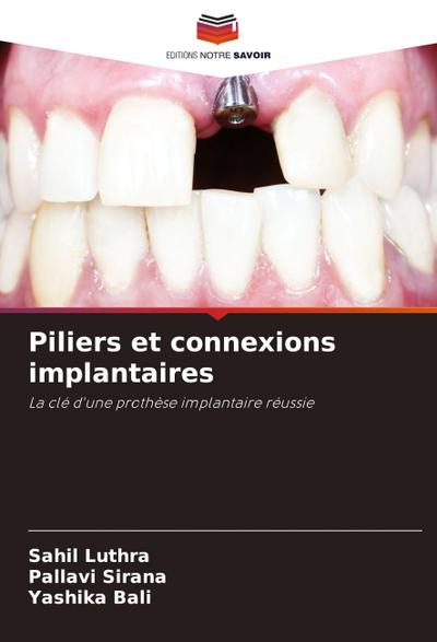 Piliers et connexions implantaires