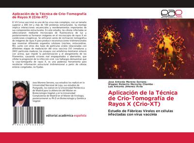Aplicación de la Técnica de Crio-Tomografía de Rayos X (Crio-XT)