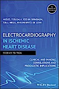 Electrocardiography in Ischemic Heart Disease