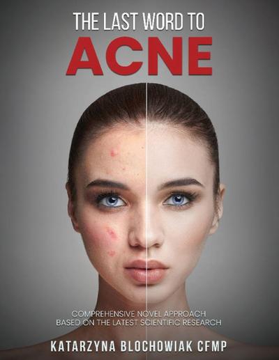 The Last Word To Acne