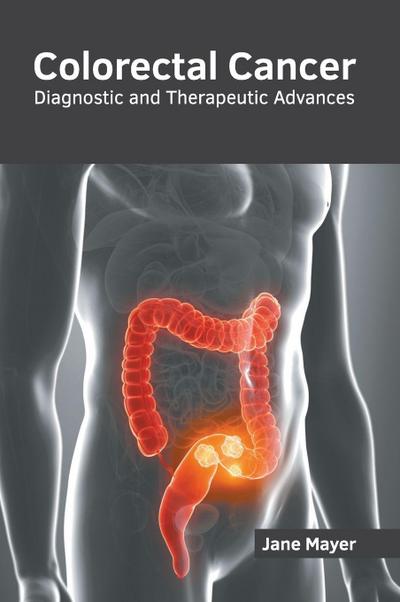 Colorectal Cancer: Diagnostic and Therapeutic Advances