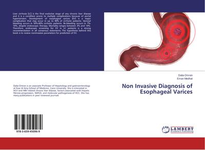 Non Invasive Diagnosis of Esophageal Varices