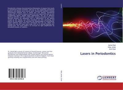 Lasers in Periodontics